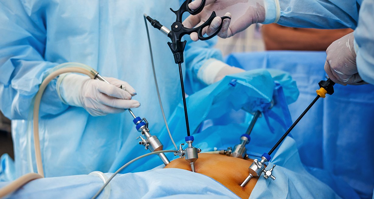 Best Laparoscopic Surgeon in Gurgaon