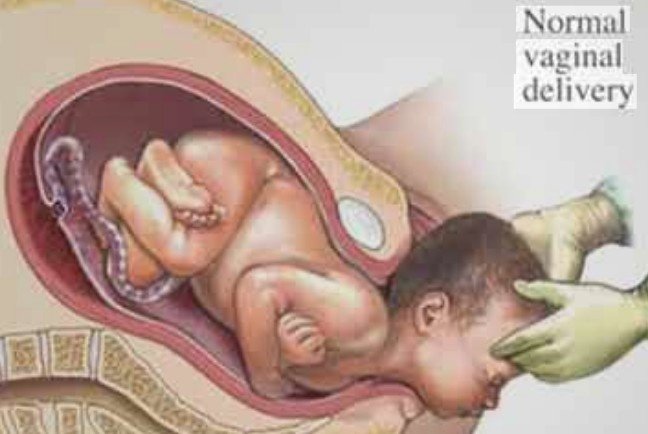 Childbirth and Pregnancy Care in Sector 4, Manesar