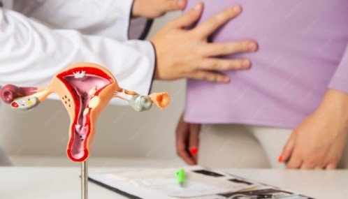PCOD Treatment in Sector 84 Gurugram